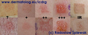 profesor UJ dr hab. med. Radosaw piewak, specjalista dermatolog i alergolog, Krakw